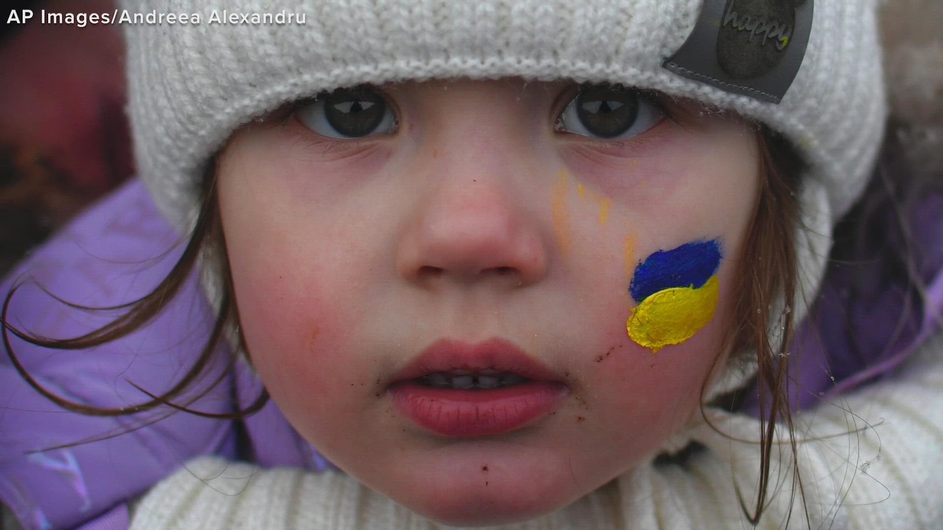 Images of those affected by Russia's invasion of Ukraine.