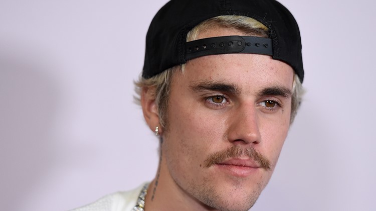 Wajah Justin Bieber lumpuh sebagian: sindrom Ramsay Hunt