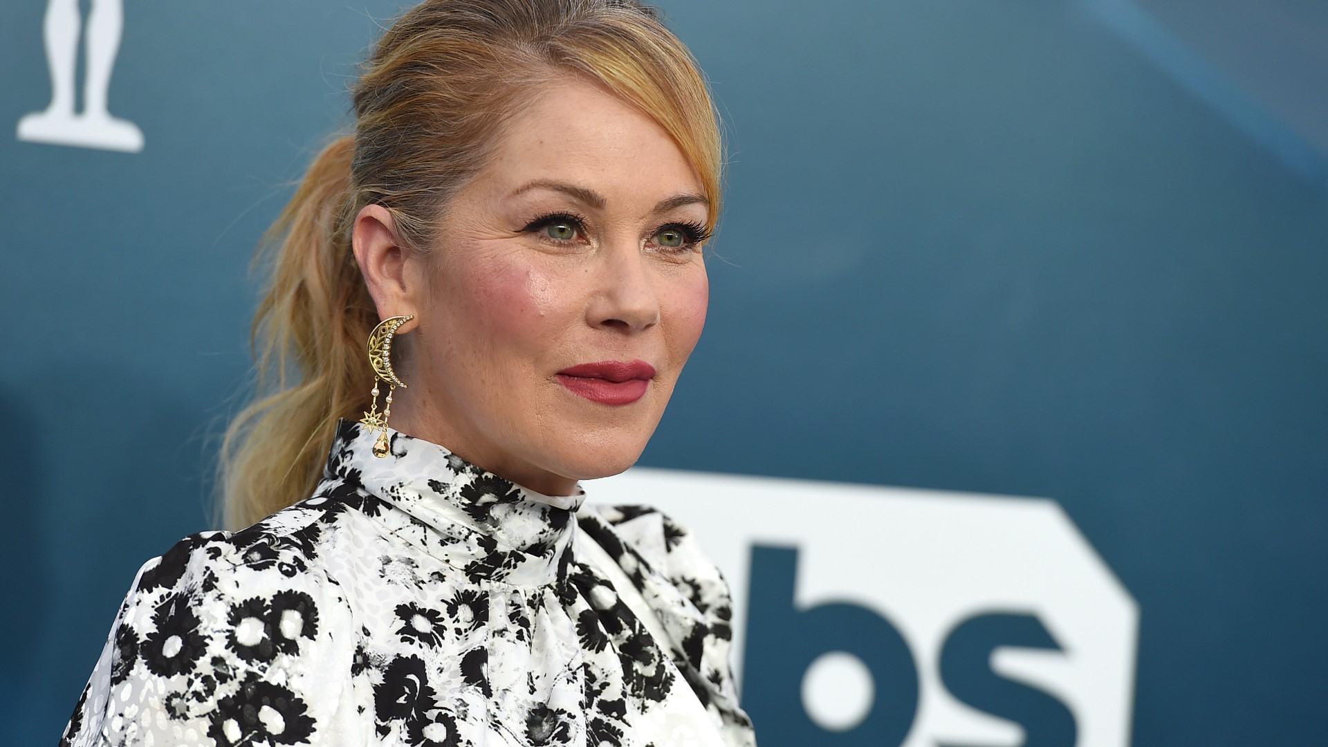 Christina Applegate Reveals Multiple Sclerosis Diagnosis 