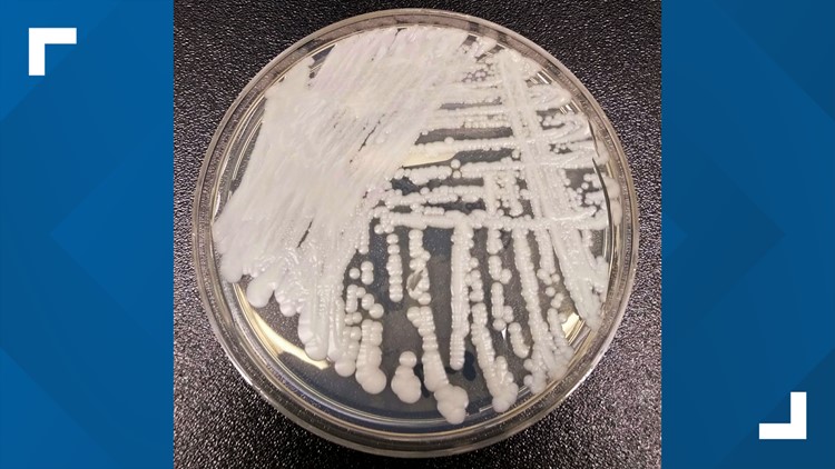 CDC warns of 'alarming' recent rise of deadly fungus