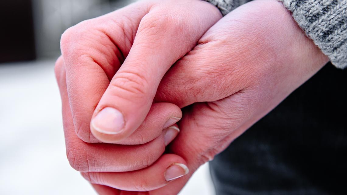 What is frostbite? Here’s how to spot the signs early | wthr.com