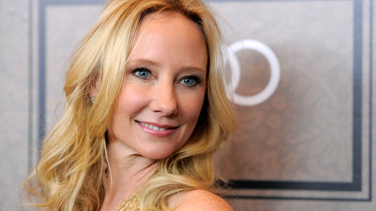 Actress Anne Heche 'declared brain dead,' family says