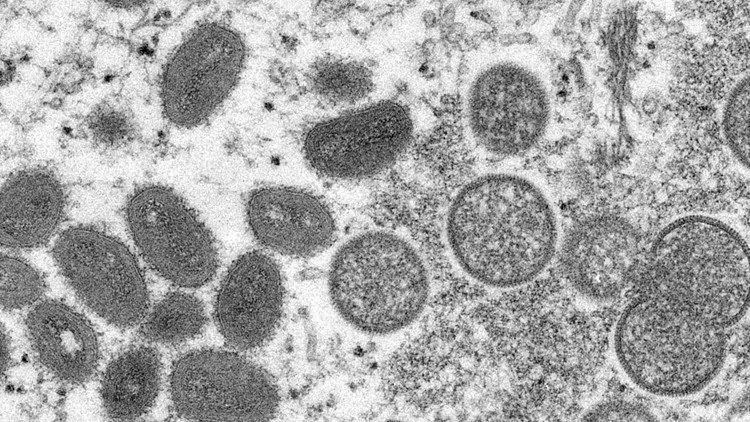 Monkeypox: WHO mengatakan pandemi tidak mungkin, pertanyaan tetap ada