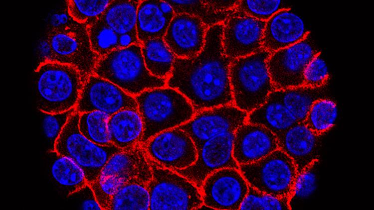 New pill nearly doubles survival time for pancreatic cancer patients