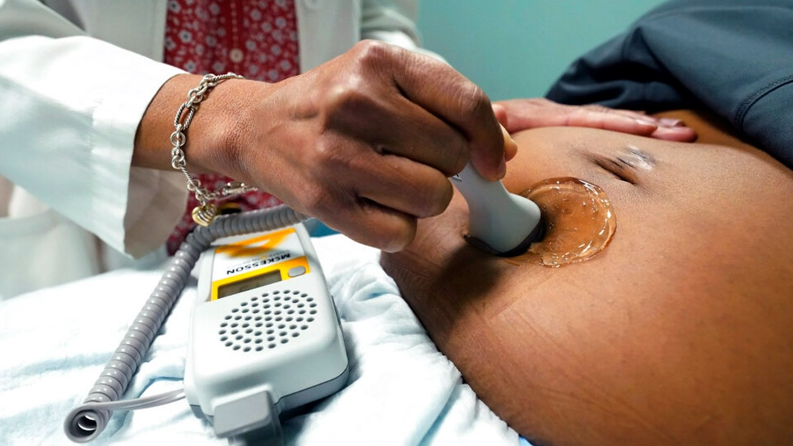 COVID-19 linked to increase in US pregnancy-related deaths COVID-19 linked to increase in US pregnancy-related deaths