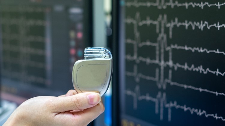 Magnets in cell phones, smart watches may affect pacemakers, implanted devices Magnets in cell phones, smart watches may affect pacemakers, implanted devices