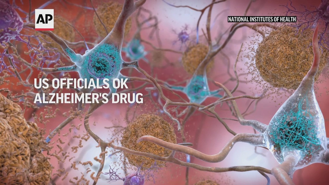 美国官方批准了新的阿尔茨海默病药物