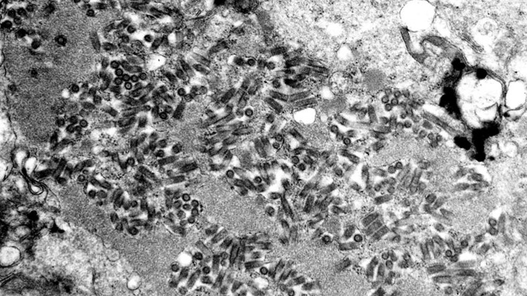 Boy, 11, dies of rabies after bat encounter during family trip
