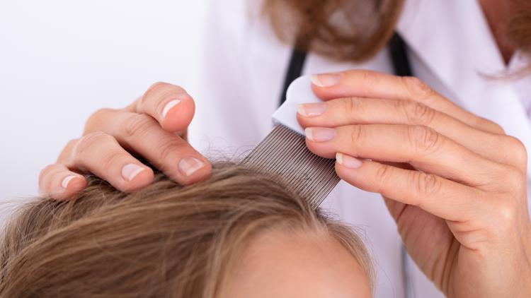 How to fight super lice | Consumer Reports