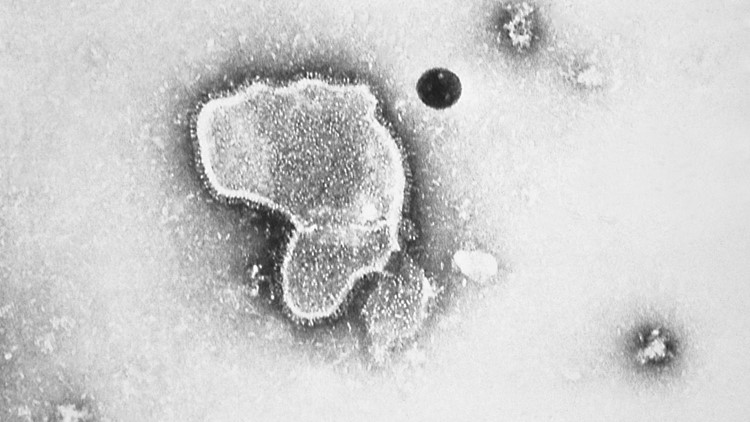 New drug to protect babies and toddlers from RSV gets FDA approval ahead of cold season New drug to protect babies and toddlers from RSV gets FDA approval ahead of cold season