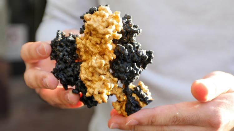 Rare 'Brain on Fire' disorder highlighted in Netflix film may soon have new treatments