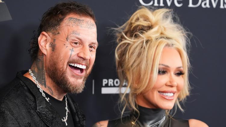 Jelly Roll reveals he went to the Grammys with a snapped collarbone after ATV crash