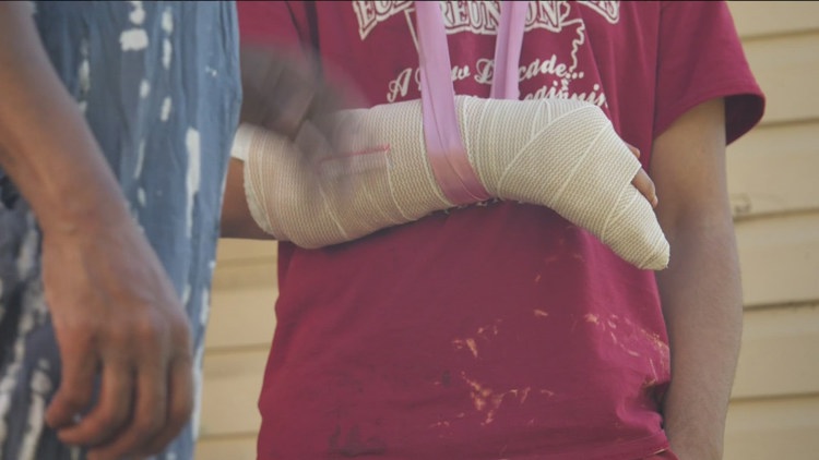 Northeast Minneapolis family recovering after pet pitbull attacks them