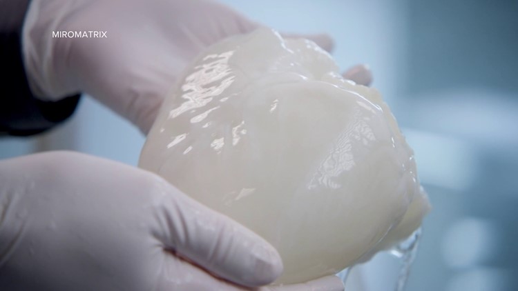 'This will be a first': Eden Prairie company works to revolutionize organ transplants