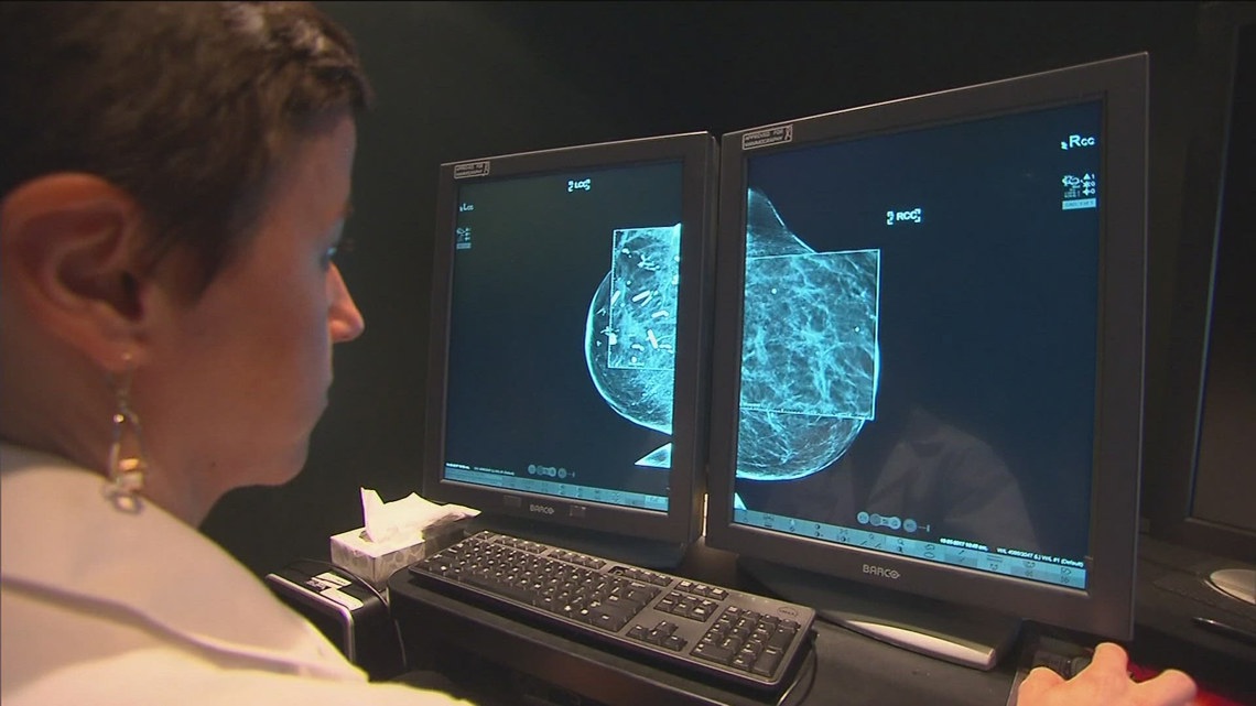 New Alabama laws mandate coverage for secondary breast, prostate cancer screenings