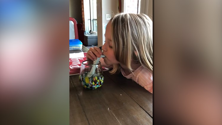 Texas doctor invents hiccup cure for children and adults