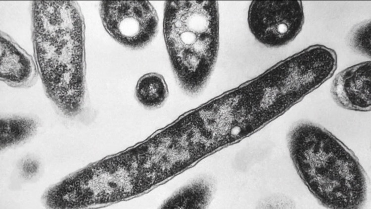 California reports no cyclosporiasis cases linked to nationwide outbreak that has sickened thousands