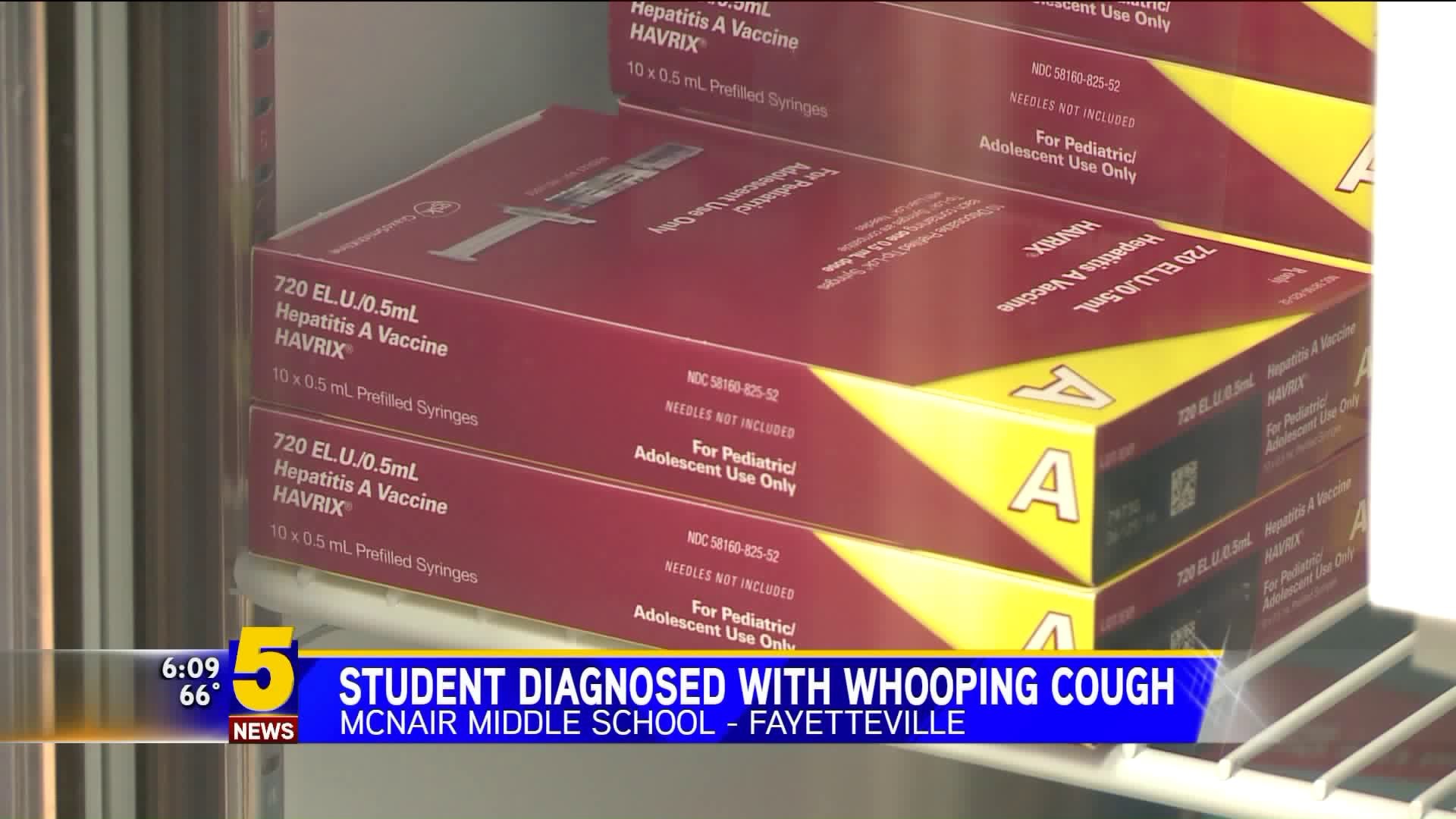 Fayetteville Student Diagnosed With Whooping Cough