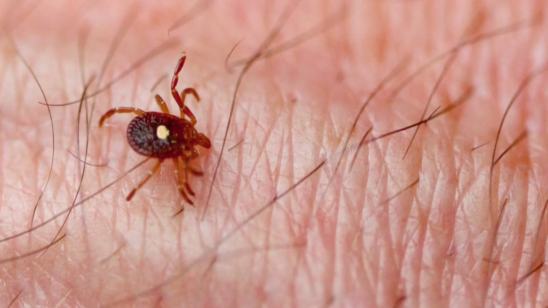 Southern Tick Rash Experts warns ticks still active as cooler fall weather begins ...