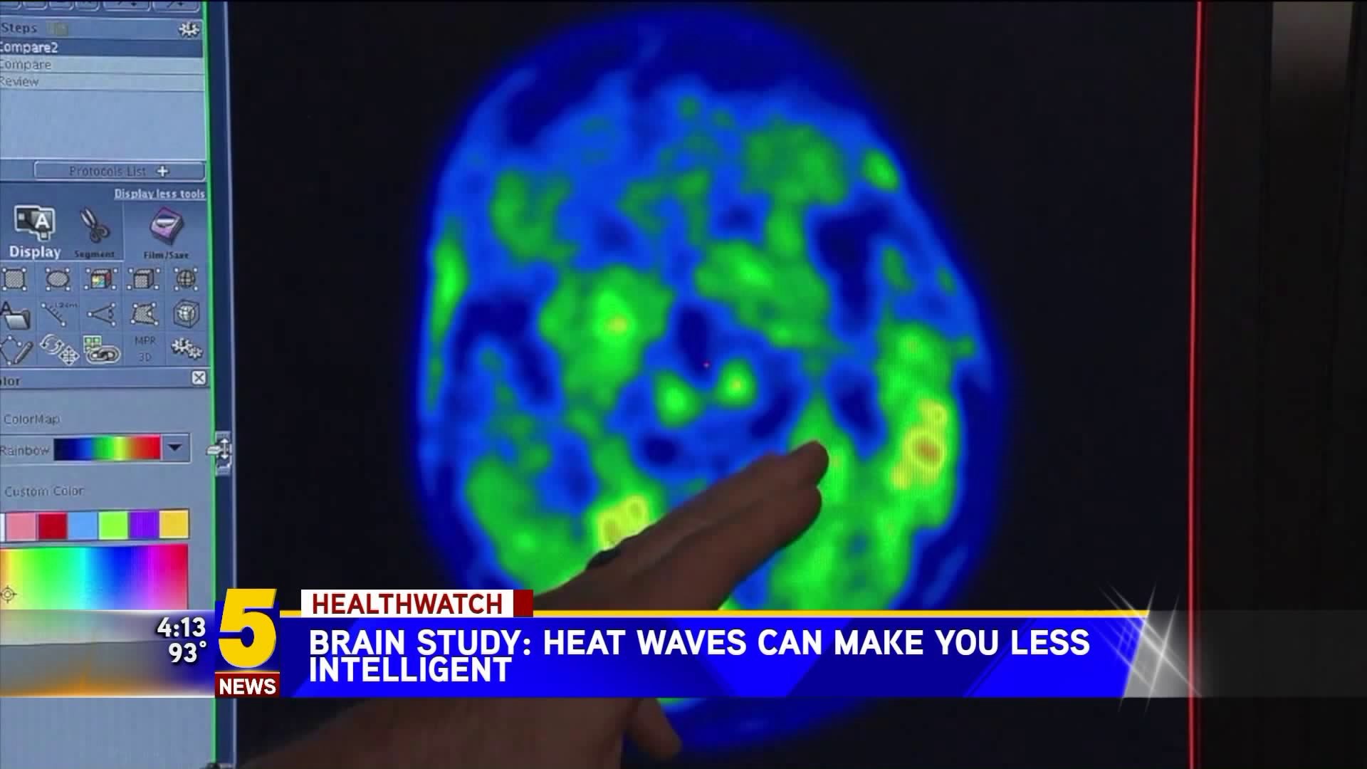 heat affecting your brain