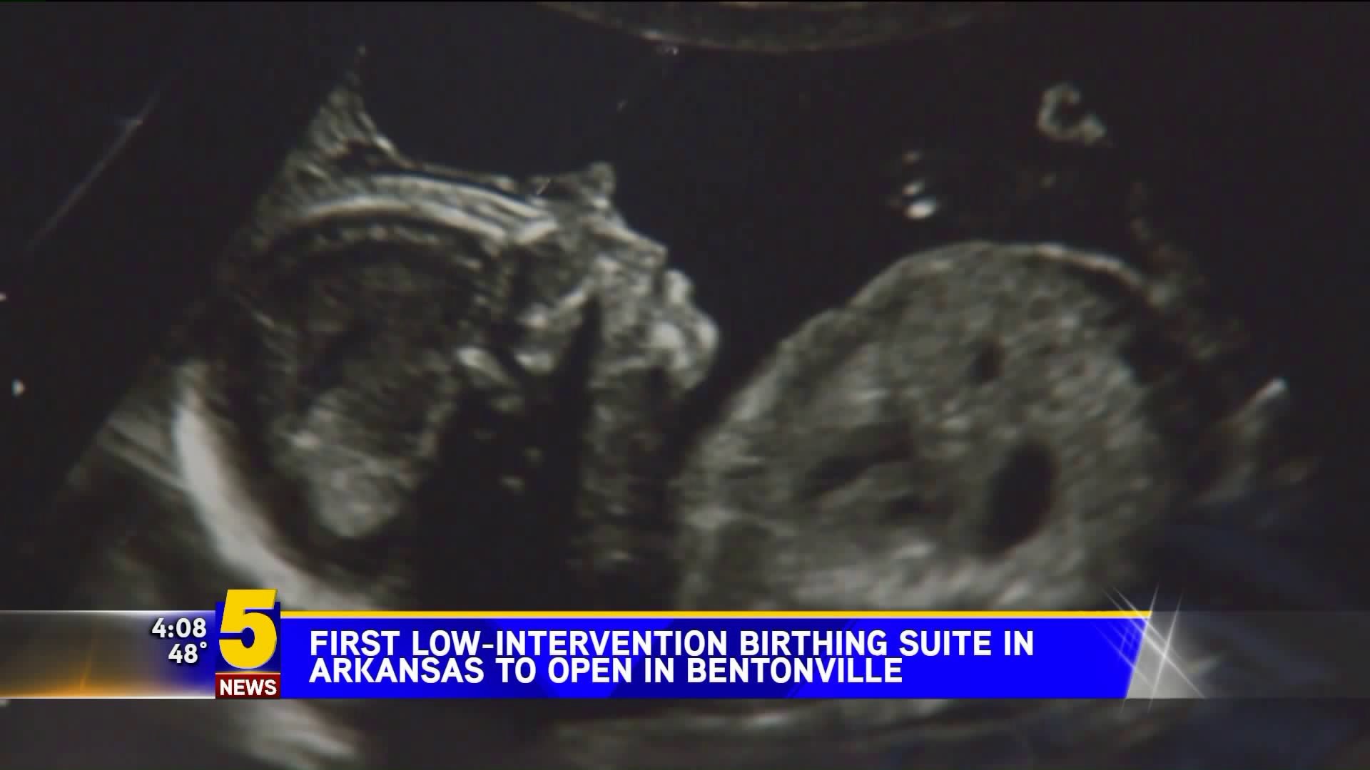 First Low Intervention Birthing Suite In Arkansas To Open In Bentonville