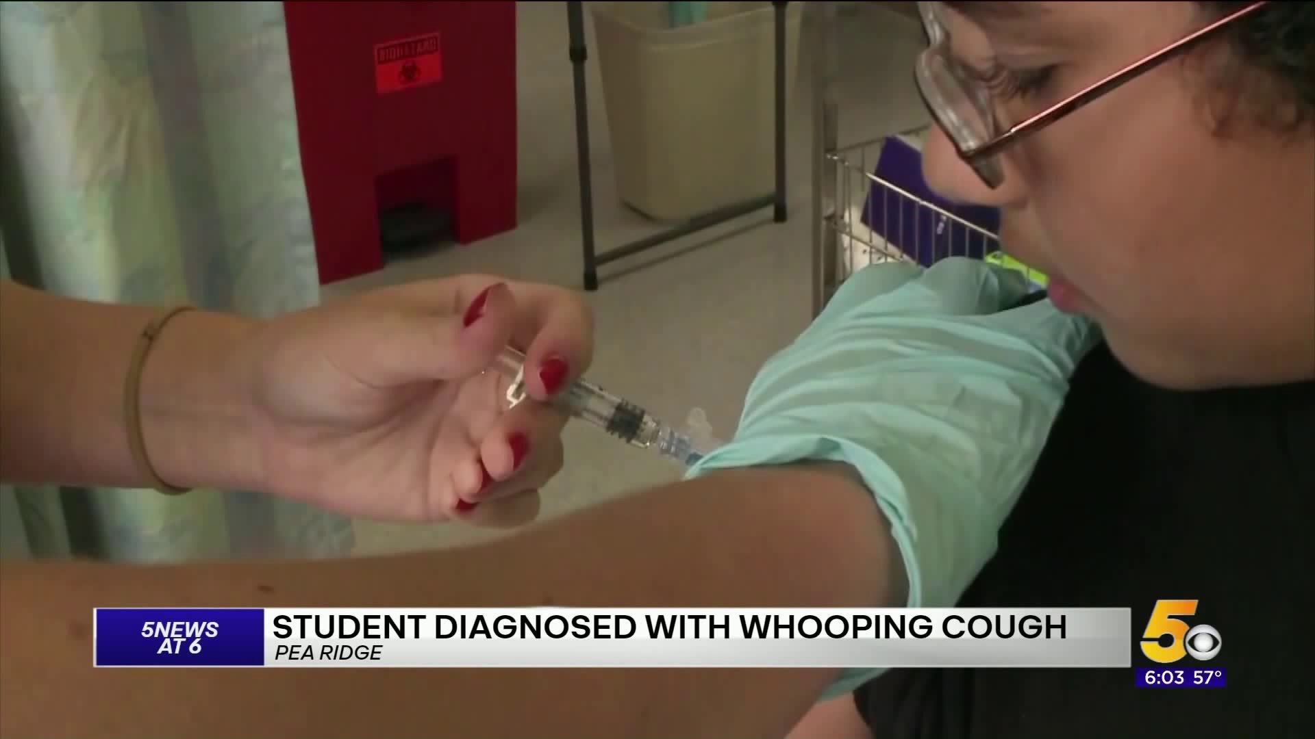 Pea Ridge Student Diagnosed With Whooping Cough