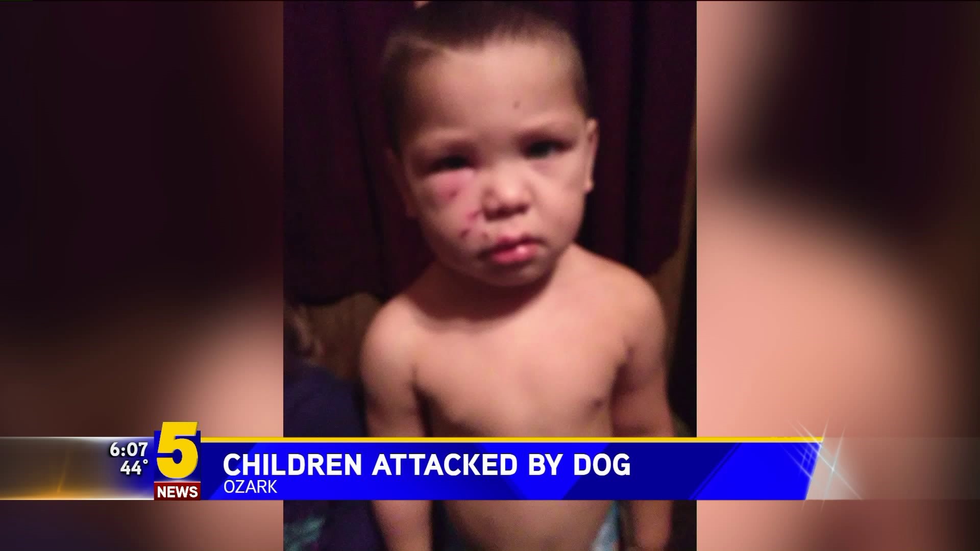 Children Attacked By A Dog