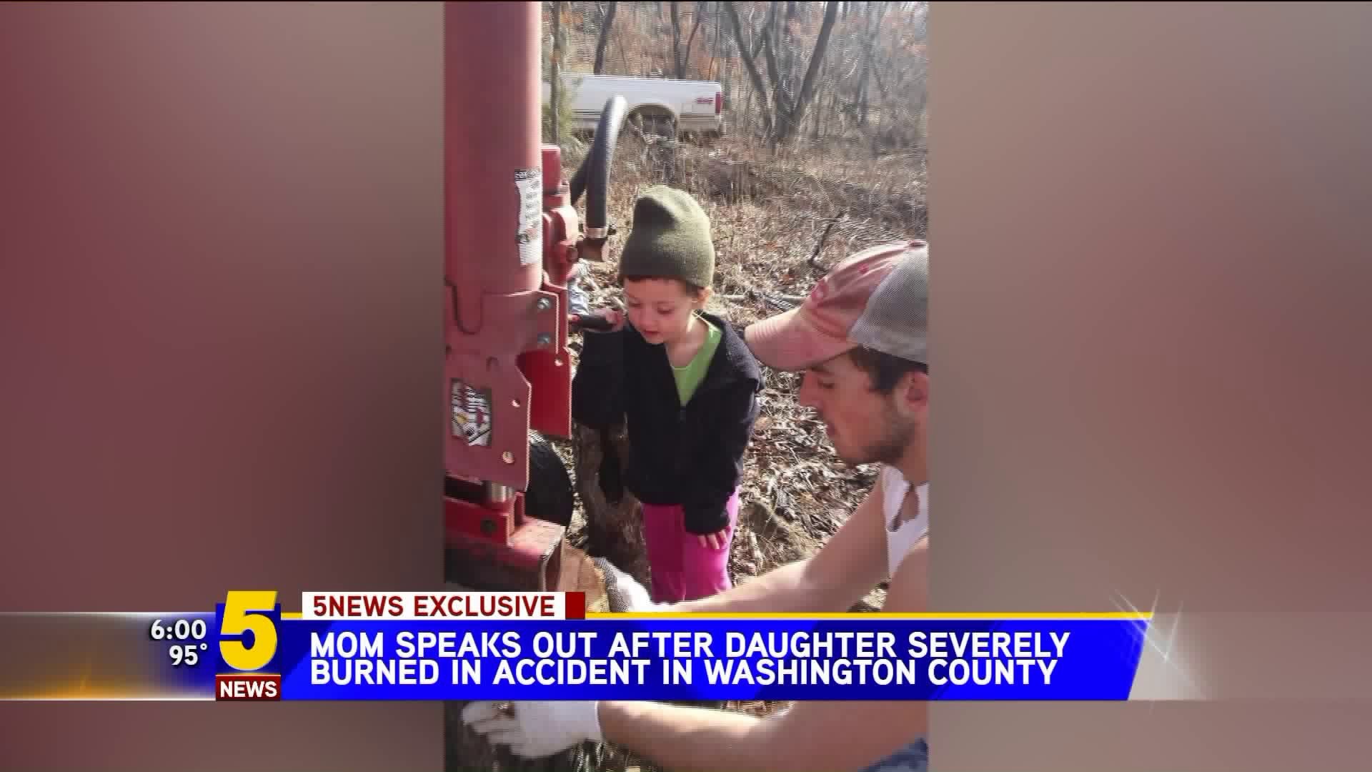 Mom Speaks After Daughter Burned In Accident