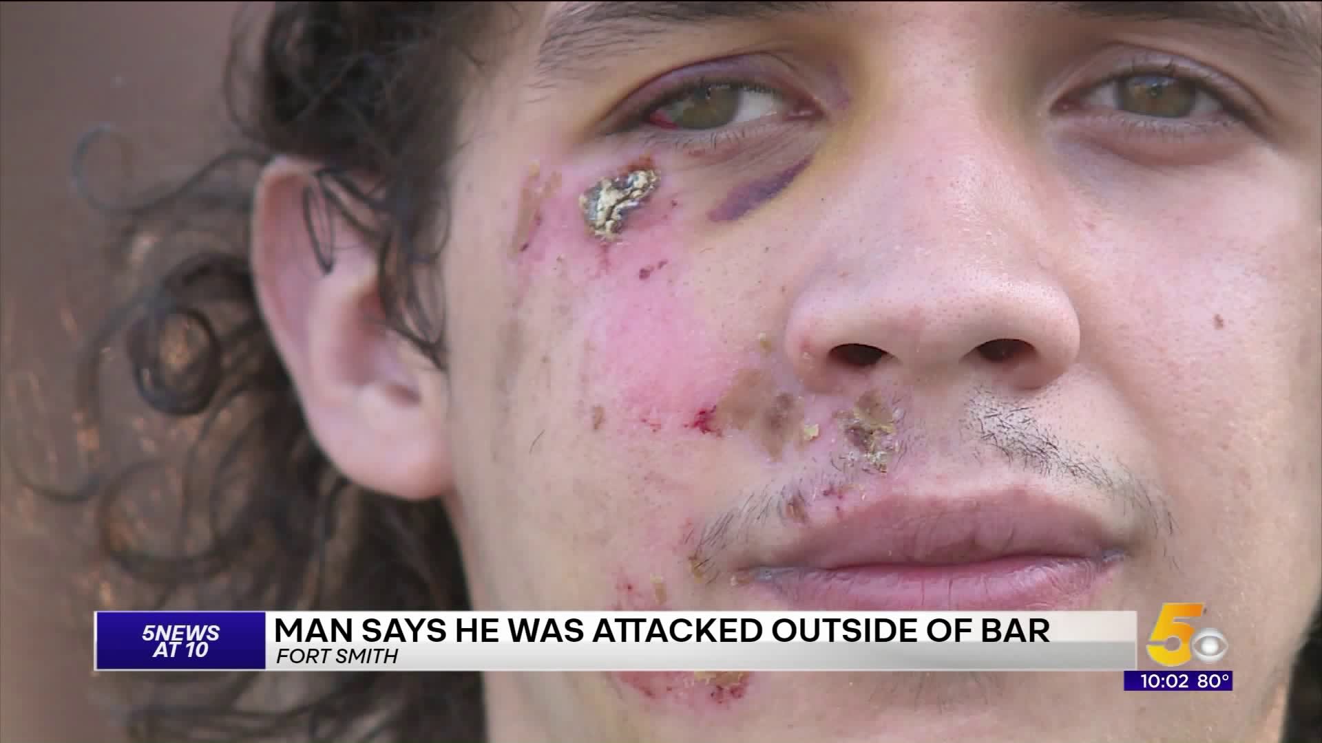 Fort Smith Man Says He As Attacked Outside Bar