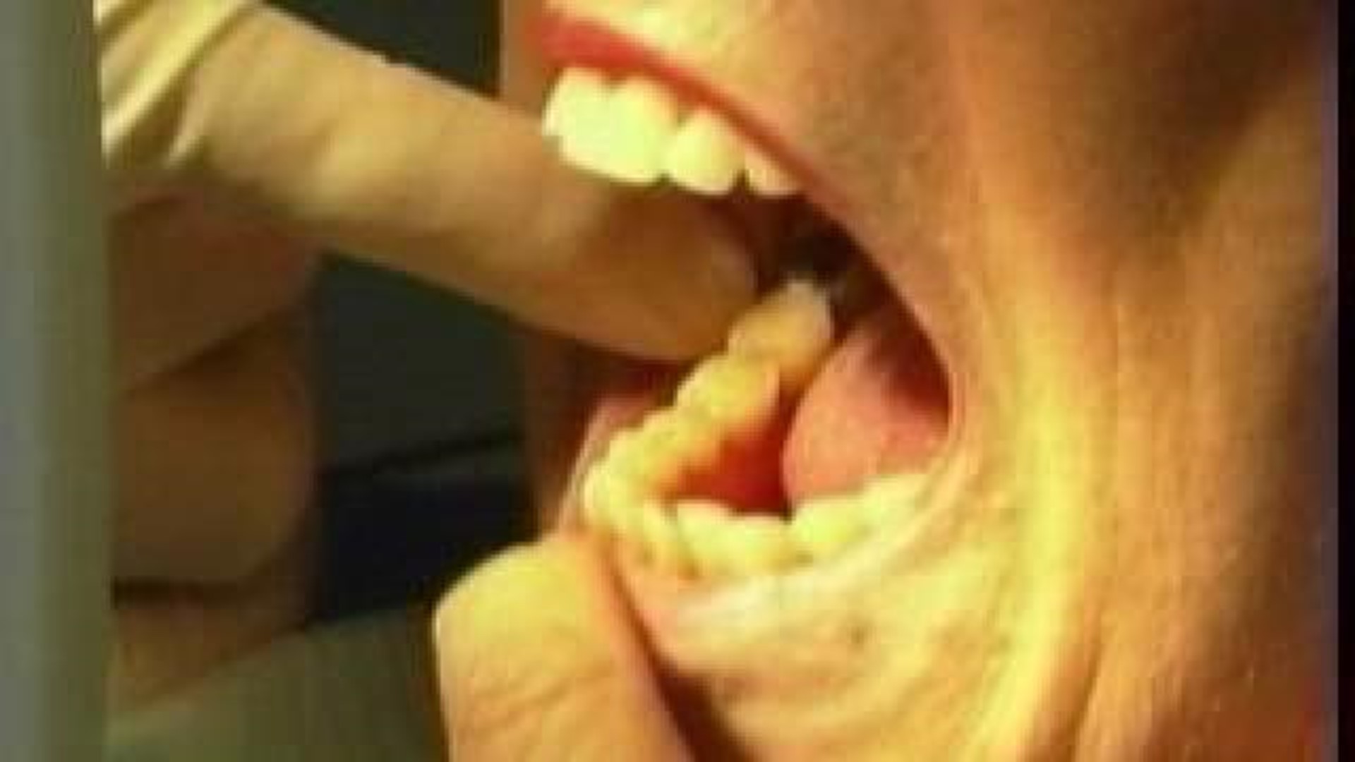Fake Oklahoma Dentist Wreaks Havoc
