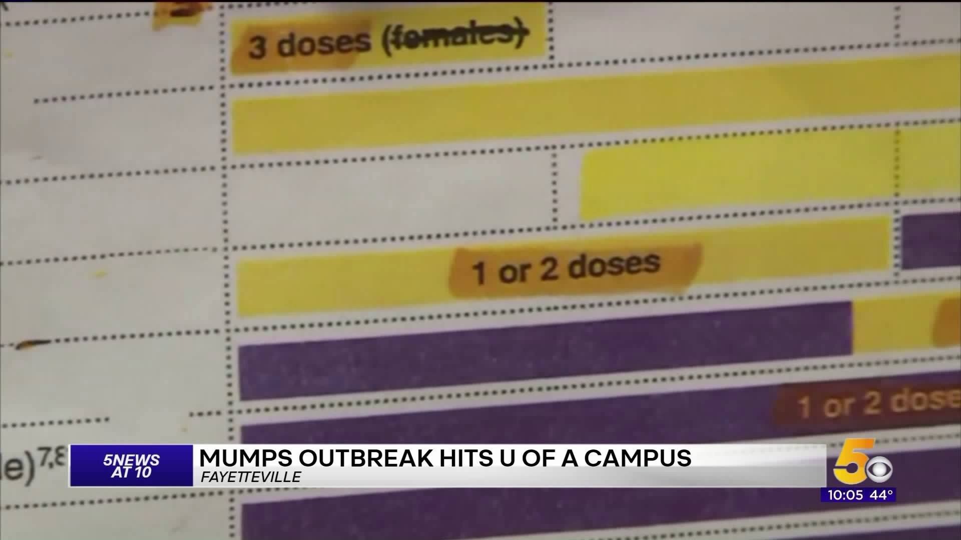 Mumps Outbreaks Hits the U of A Campus