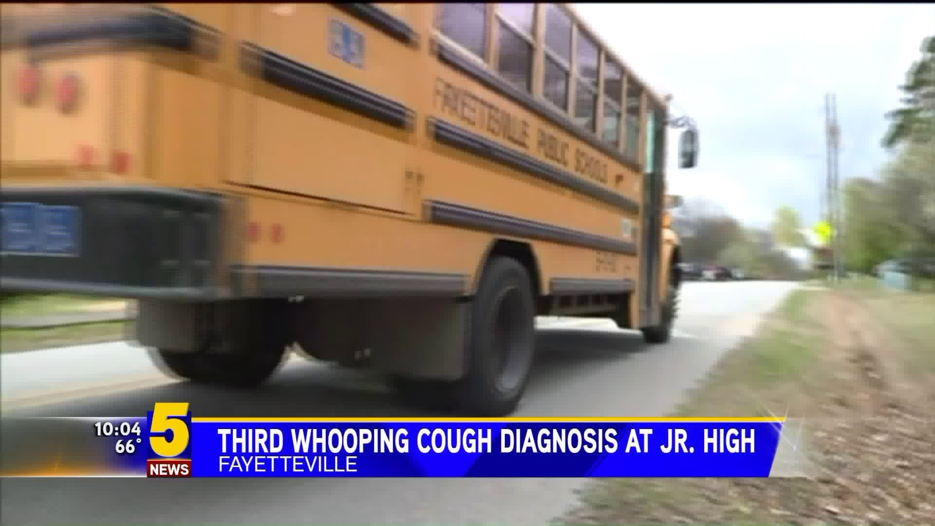 Third Whooping Cough Diagnosis At Woodland Jr. High