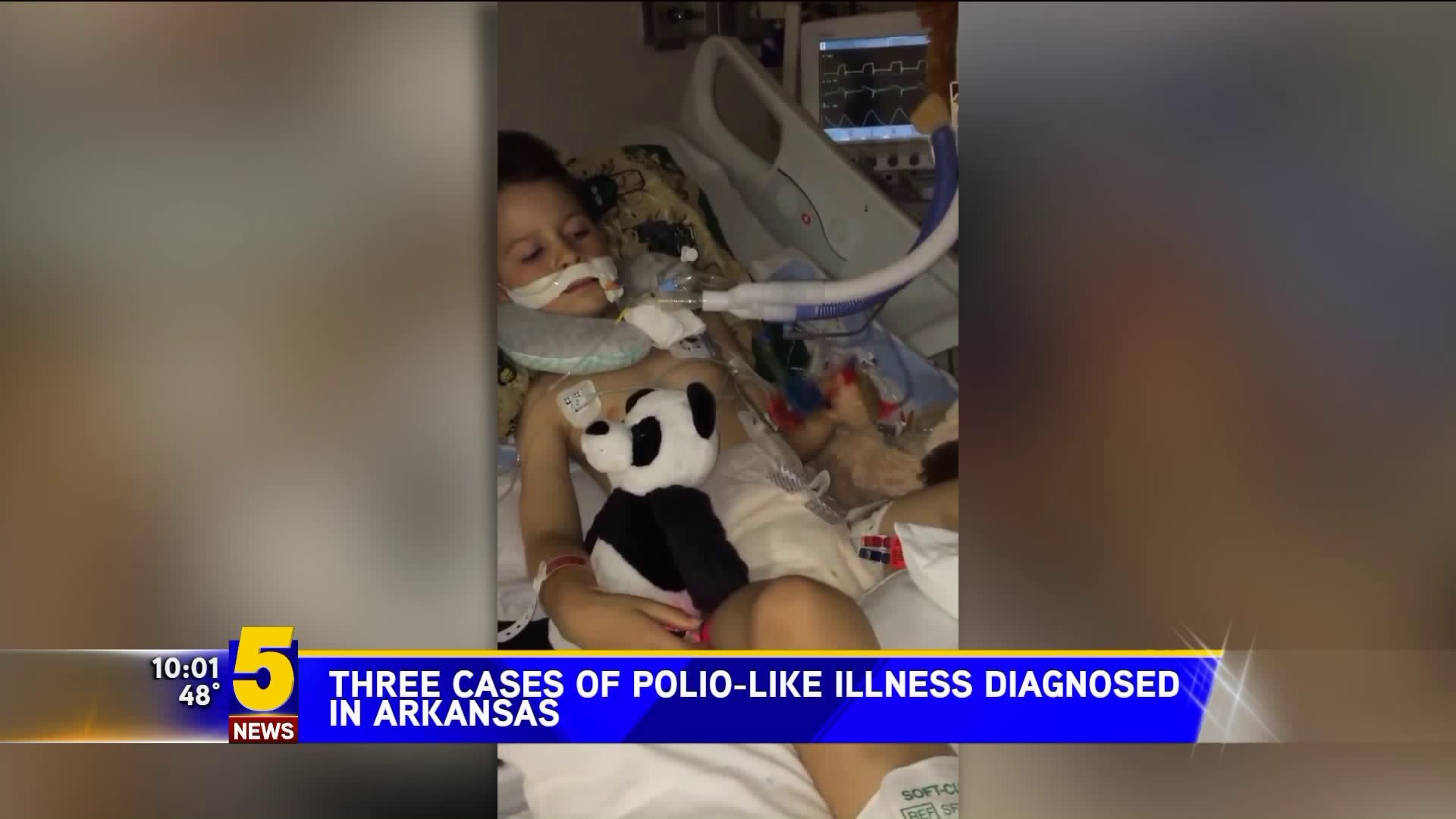 Three Cases Of Polio Like Illness Diagnosed In Arkansas