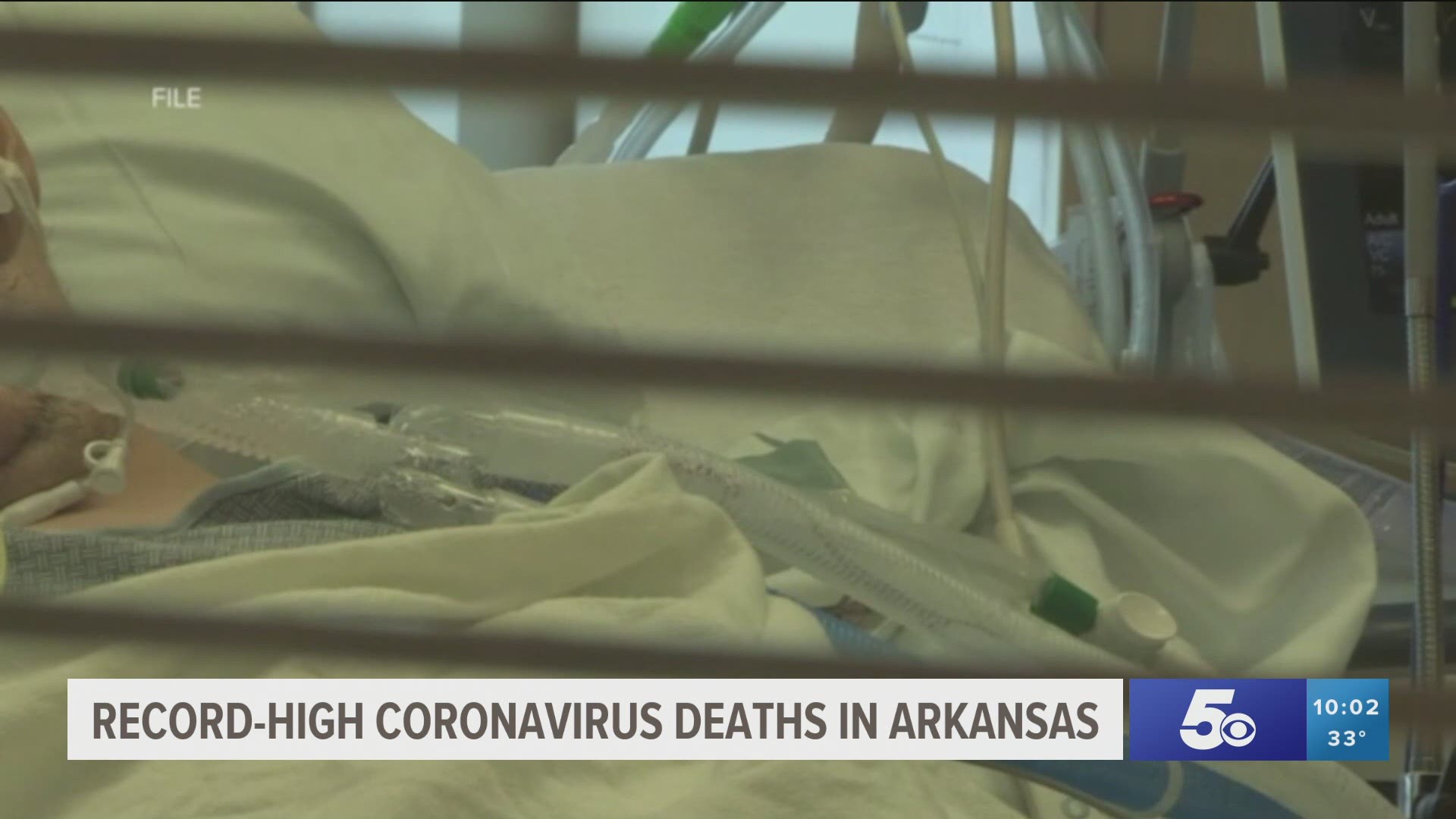 Arkansas reported 53 new covid-related deaths on Monday, a single-day record for the state.