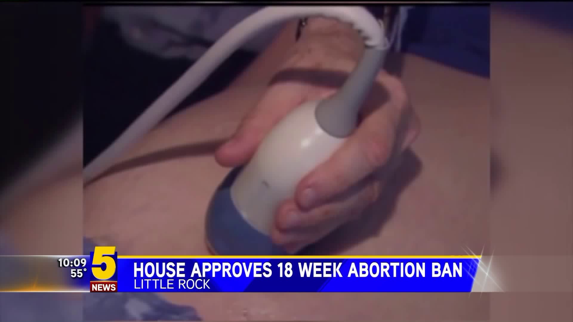 House Approves 18 Week Abortion Ban