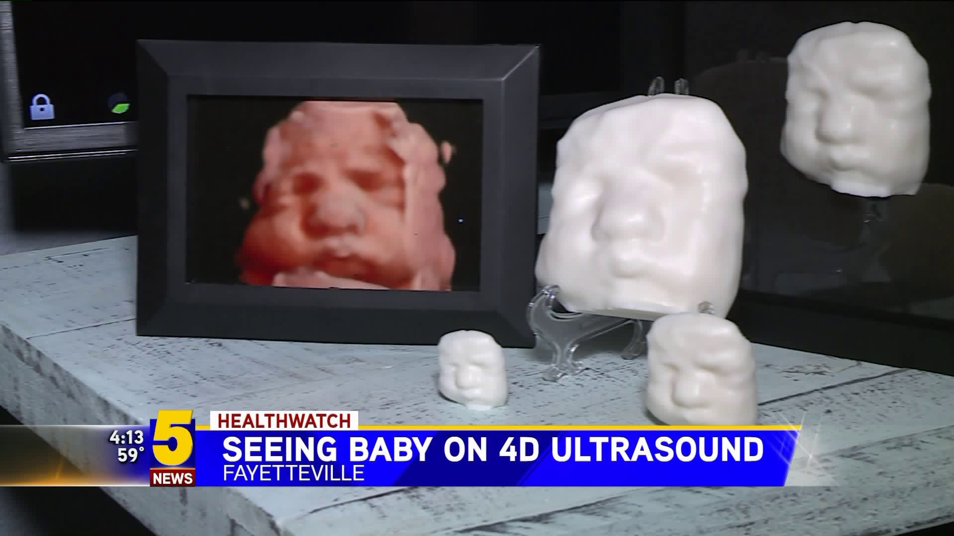 Seeing Baby On 4-D Ultrasound