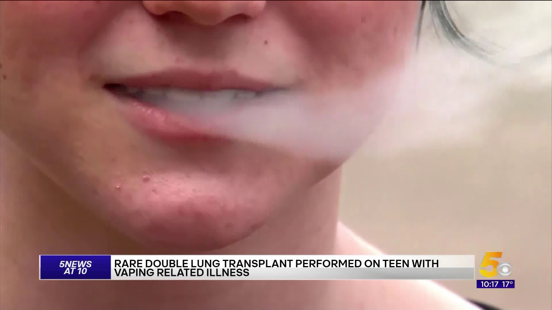 Teen Receives Double Lung Transplant After Vaping-Related Illness