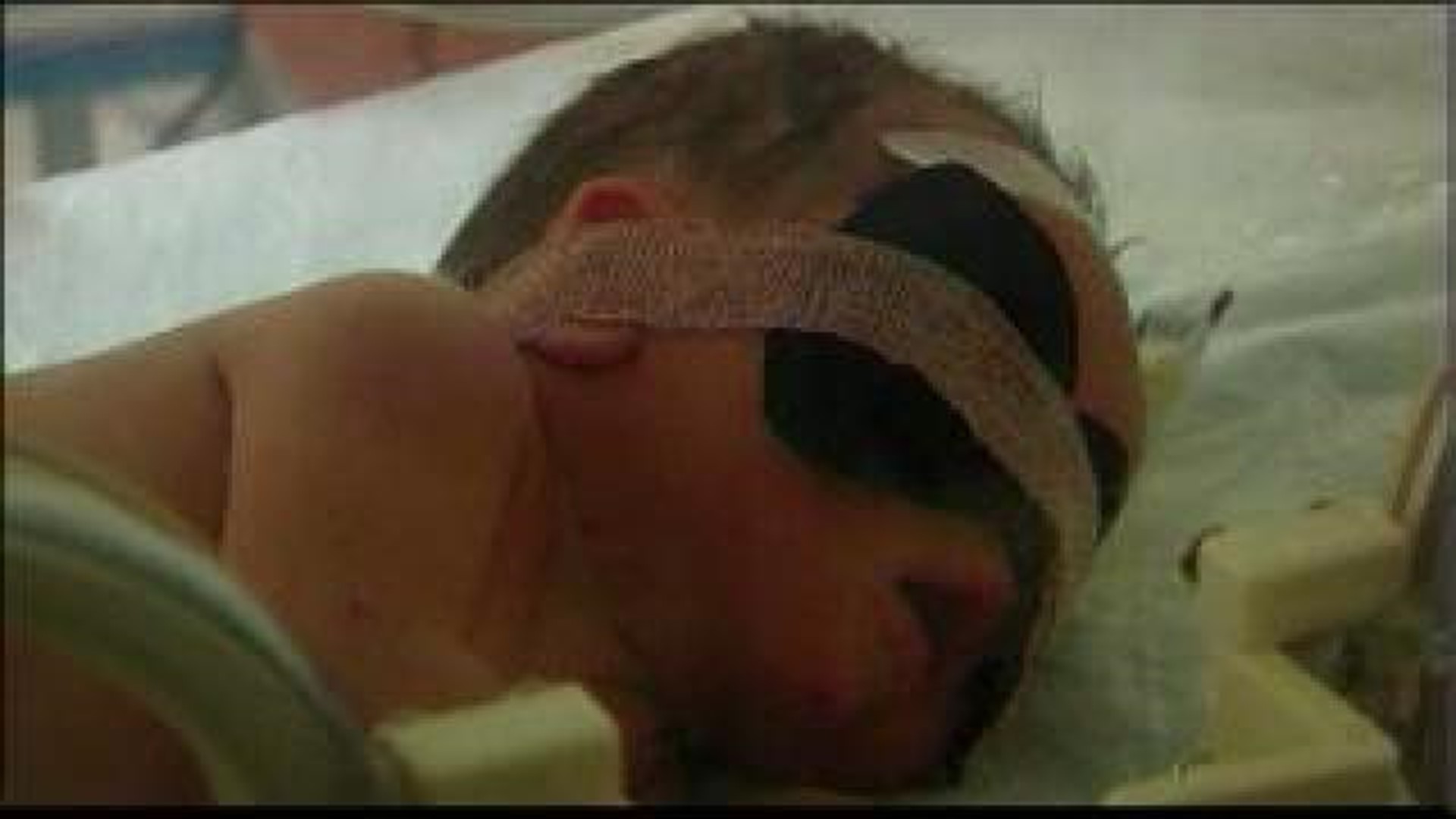 Newborn Recovering After Flushed Down Sewer Pipe