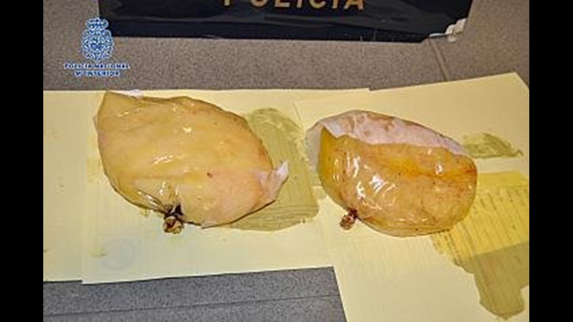 Woman Busted in Spain for Cocaine in Breast Implants 5newsonline