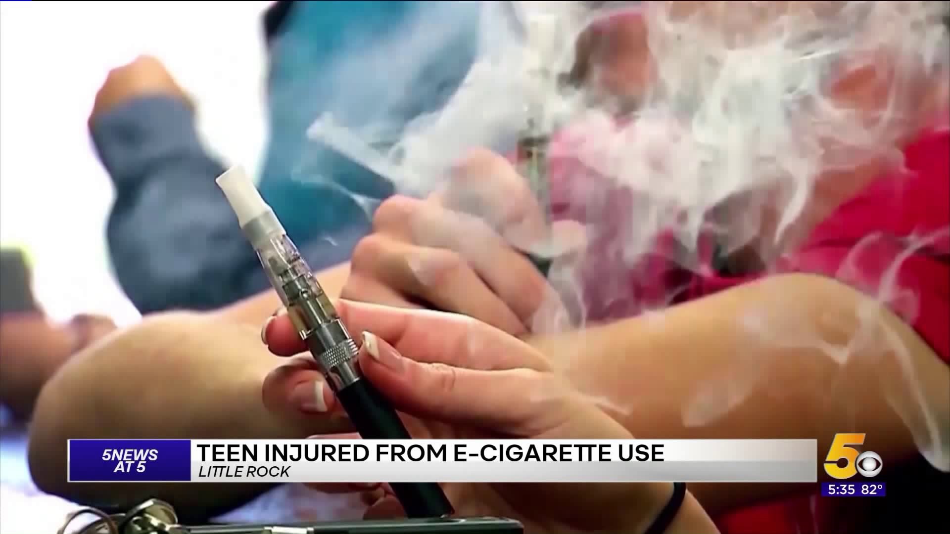 TEEN INJURED FROM ECIGARRETTE USE