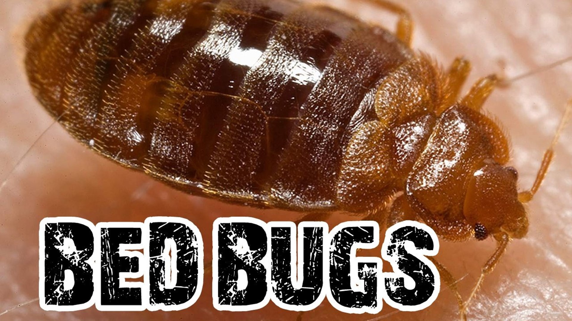 Woman Allows Thousands Of Bedbugs To Feed On Her Over 5 Years Makes