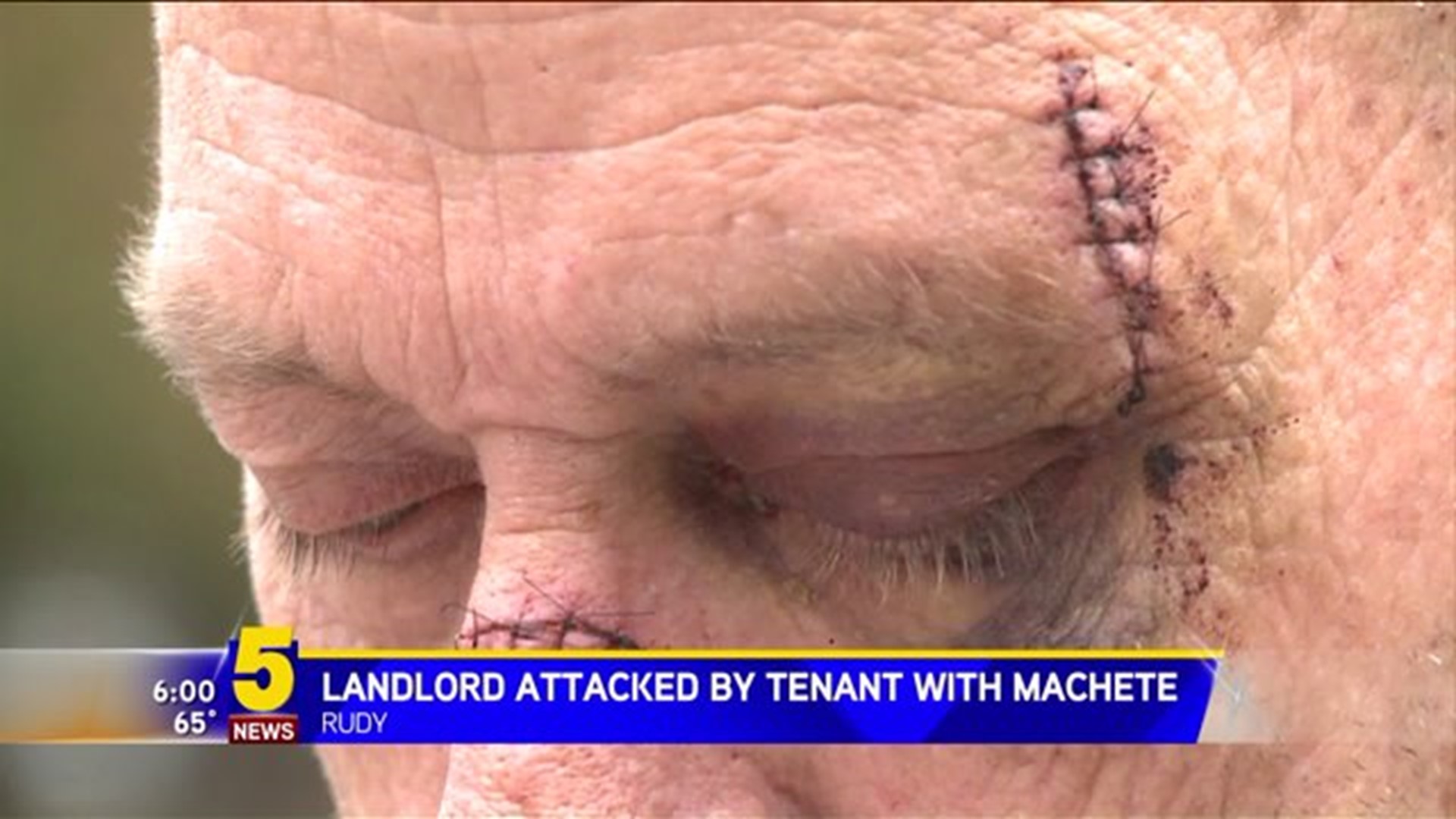 TENANT ATTACKS LANDLORD WITH MACHETE