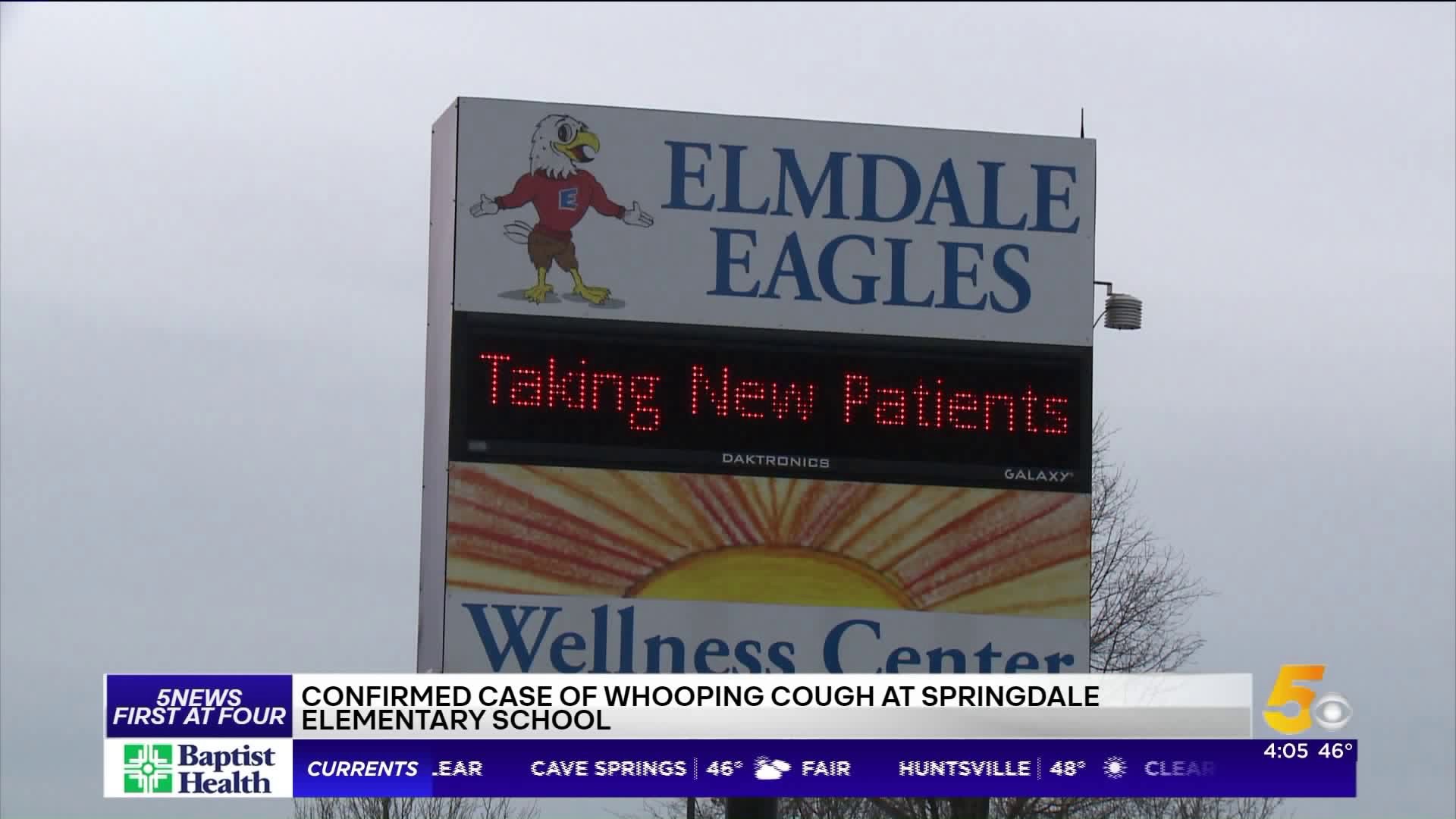 Case Of Whooping Cough Confirmed At Springdale Elementary School