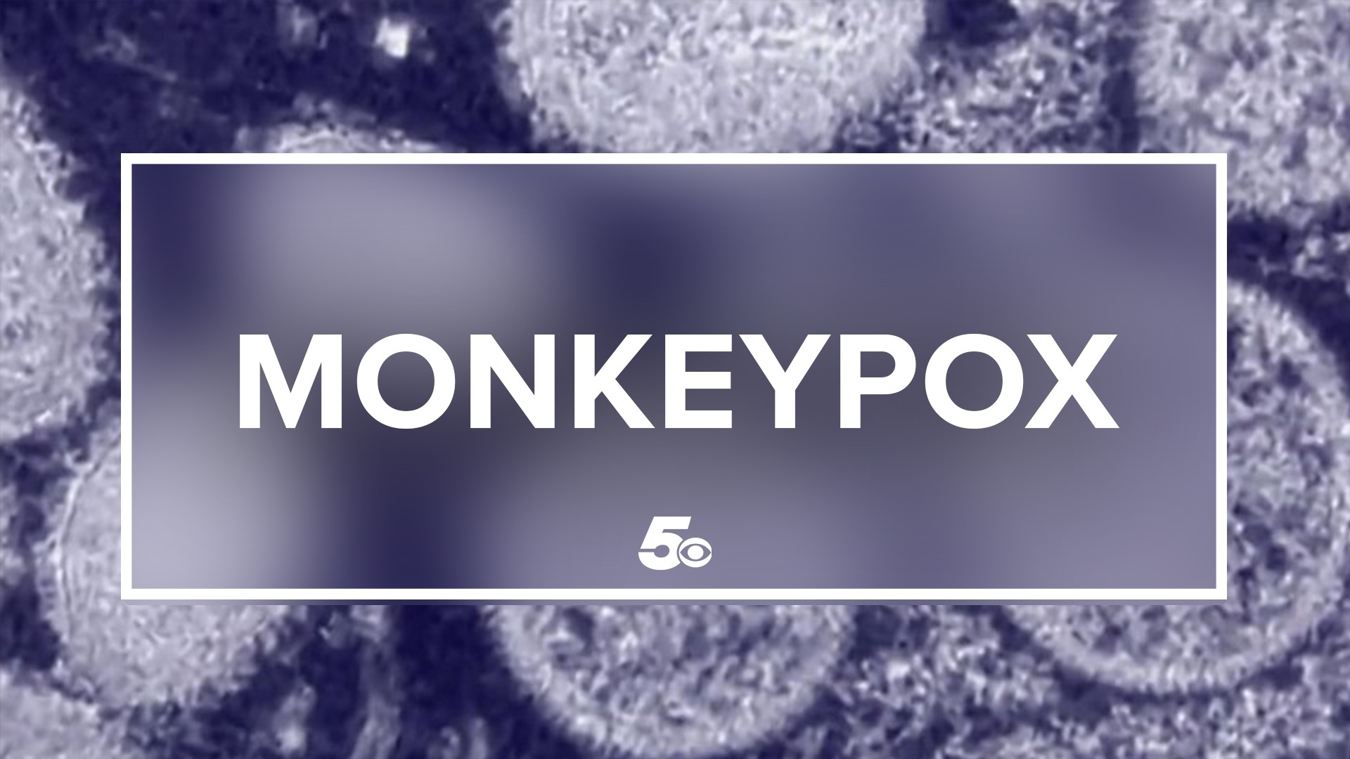 Health officials say monkeypox is in the same family of viruses as Smallpox but it is less contagious and not anywhere near as deadly.