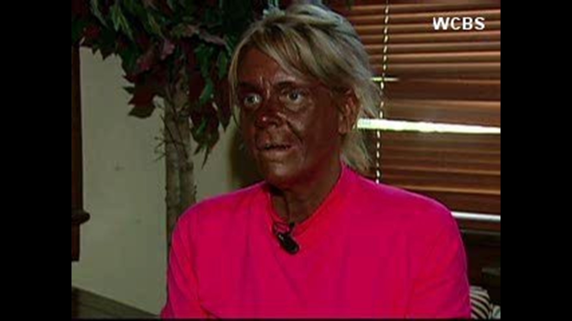 CNN: Mom accused of taking daughter to tanning bed