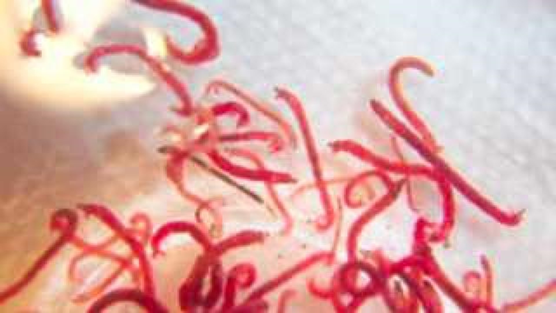 Blood Worms In Water Close Schools For Rest Of Week
