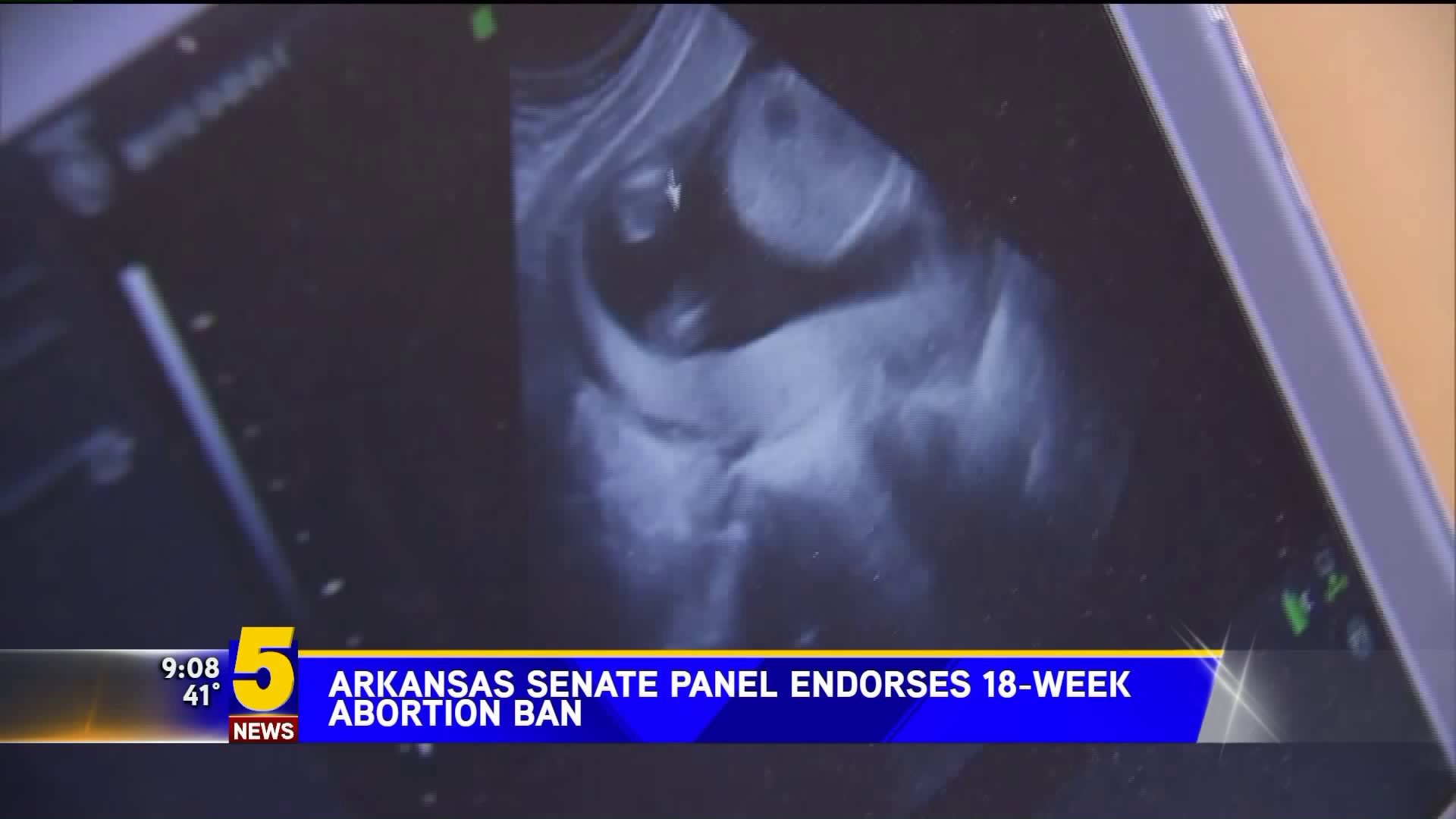 AR Senate Panel Endorses 18 Week Abortion Ban