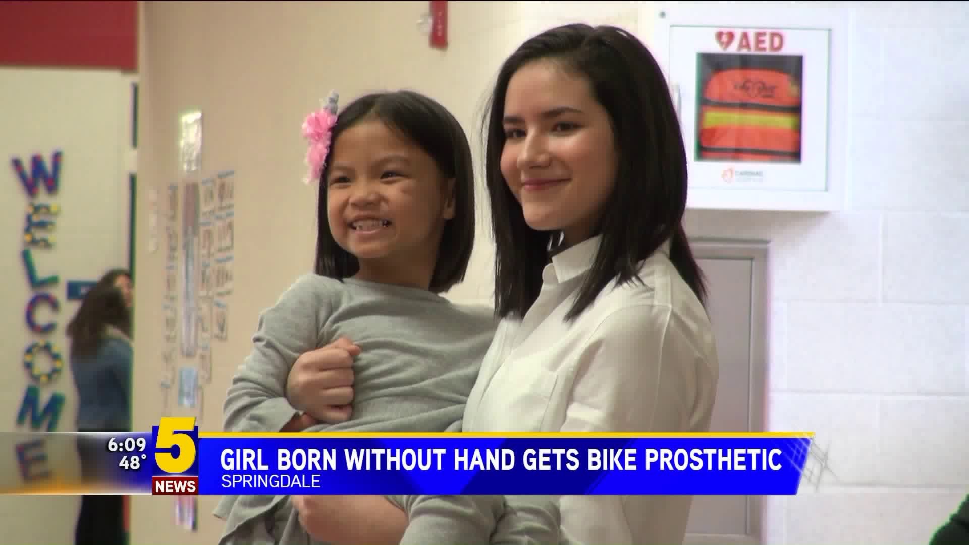 Girl Born Without Hand Gets Bike Prosthetic