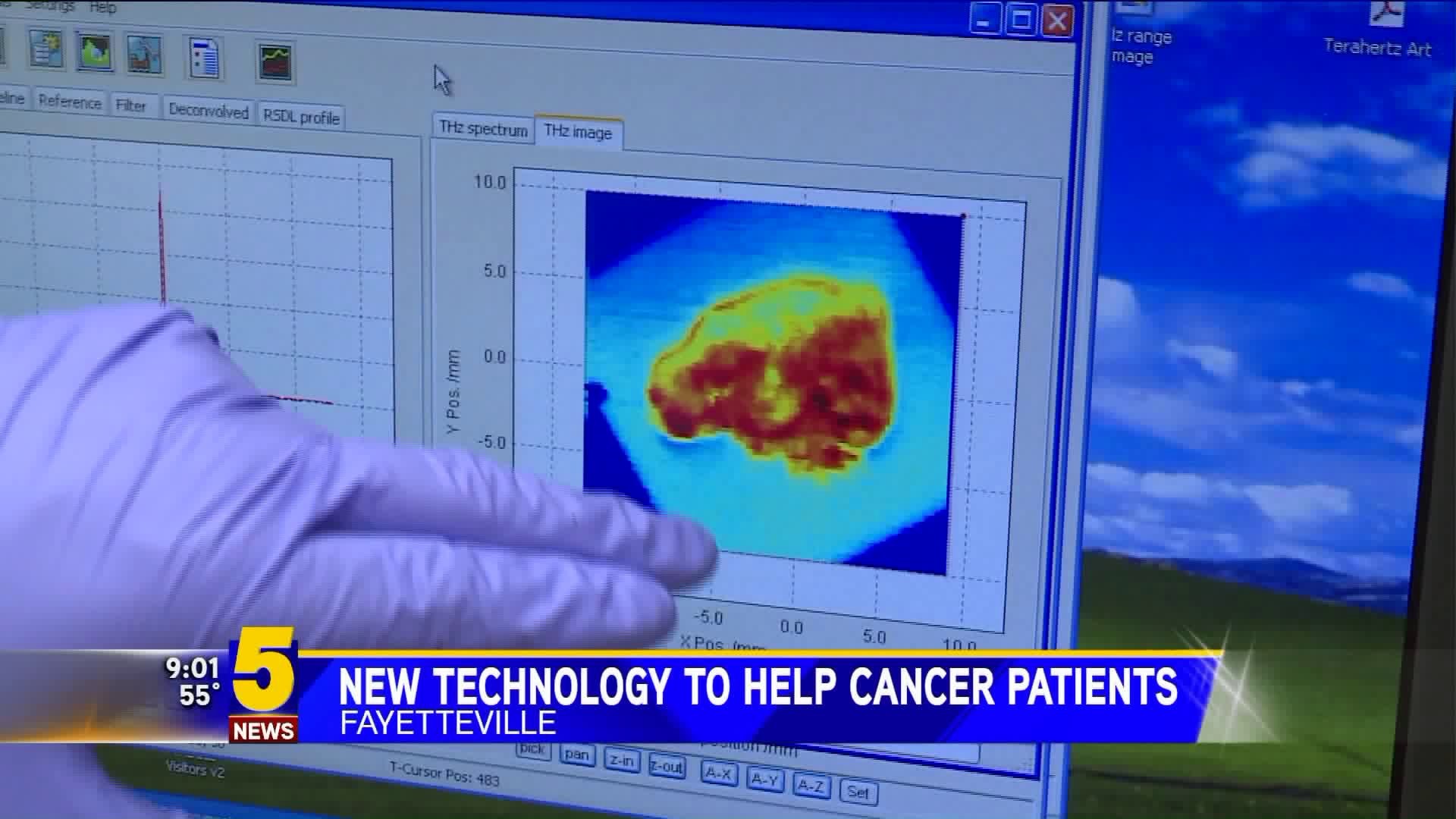 New Technology To Help Cancer Patients