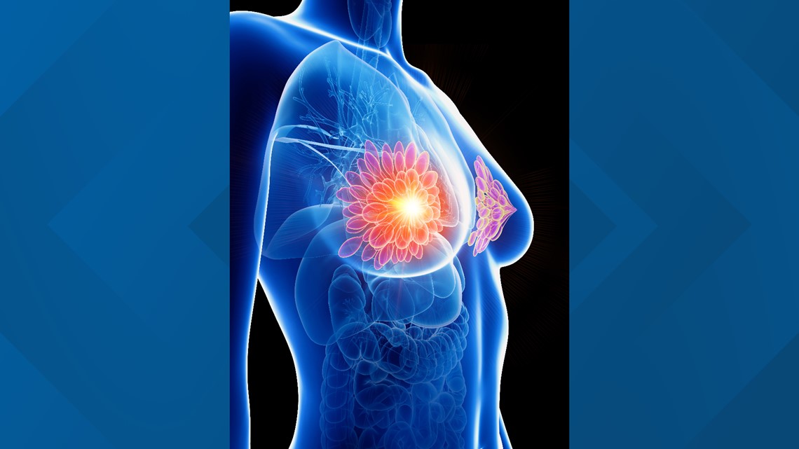 Northwest Medical Center Bentonville offering 3D mammograms